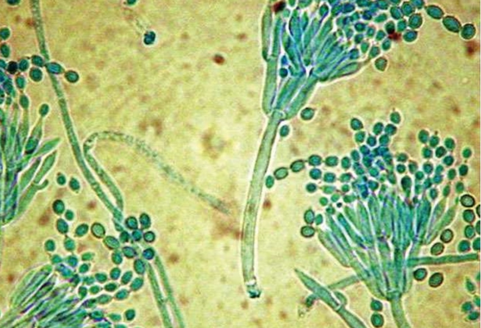 Строение пеницилла под микроскопом. Penicillium notatum пенициллин. Пенициллиум плесневый гриб. Пеницилл в микроскопе. Плесень пенициллиум.